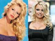 O que há de errado com Pamela Anderson?