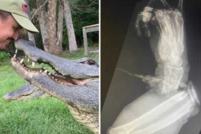 Tratador de jacaré perde parte do antebraço após ataque do animal em zoo nos EUA