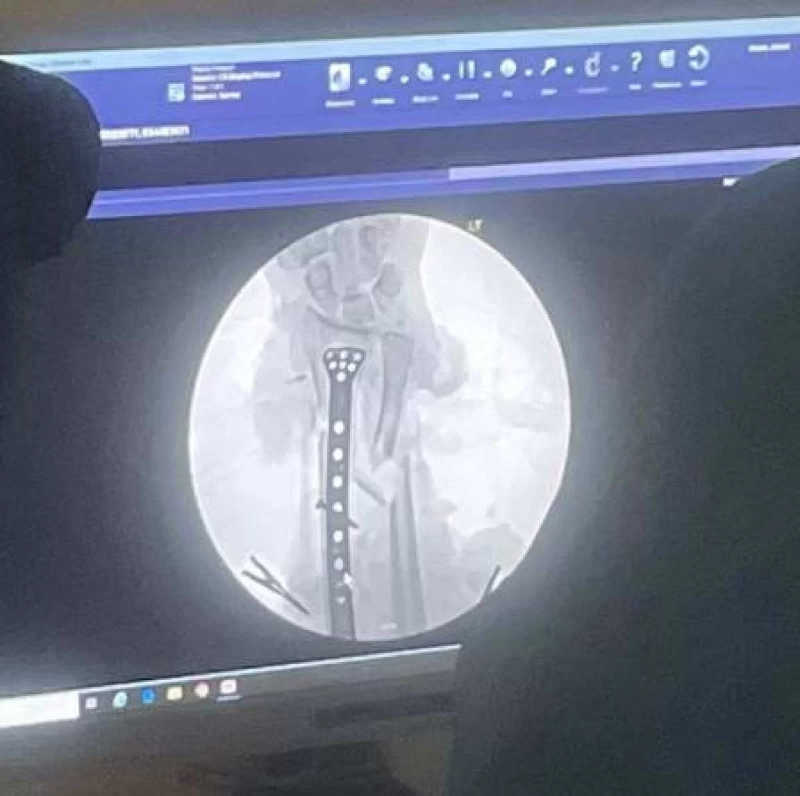 Médicos tentam recuperar o antebraço de Greg (crédito: Reprodução/Facebook/Florida Gator Gardens)