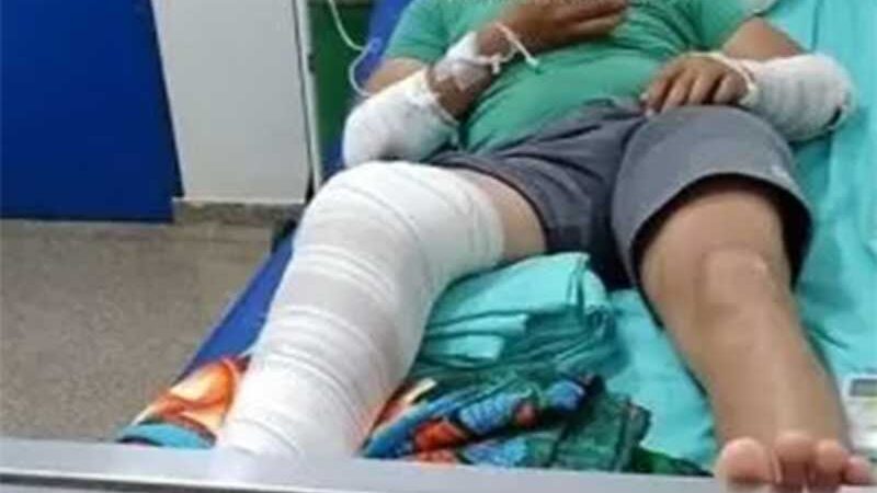 Pit bull abandonado por tutor que se mudou morre atropelado em Cabixi, RO; motociclista ficou ferido