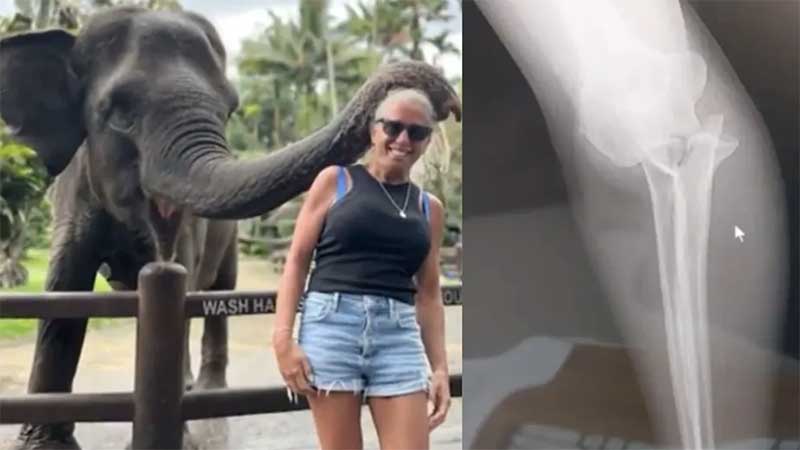 Turista tem braço mordido por elefante em viagem para Bali: ‘Estalo dos ossos me deixou em pânico’