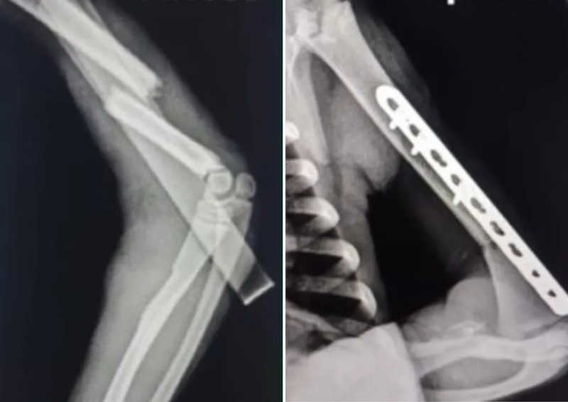 À esquerda o raio-x mostra a fratura no braço esquerdo do animal, à direta, o resultado da cirurgia. — Foto: Divulgação/Clínica Espaço Pet